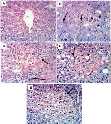 Ceiba pentandra ethyl acetate extract improves doxorubicin antitumor outcomes against chemically induced liver cancer in rat model: a study supported by UHPLC-Q-TOF-MS/MS identification of the bioactive phytomolecules